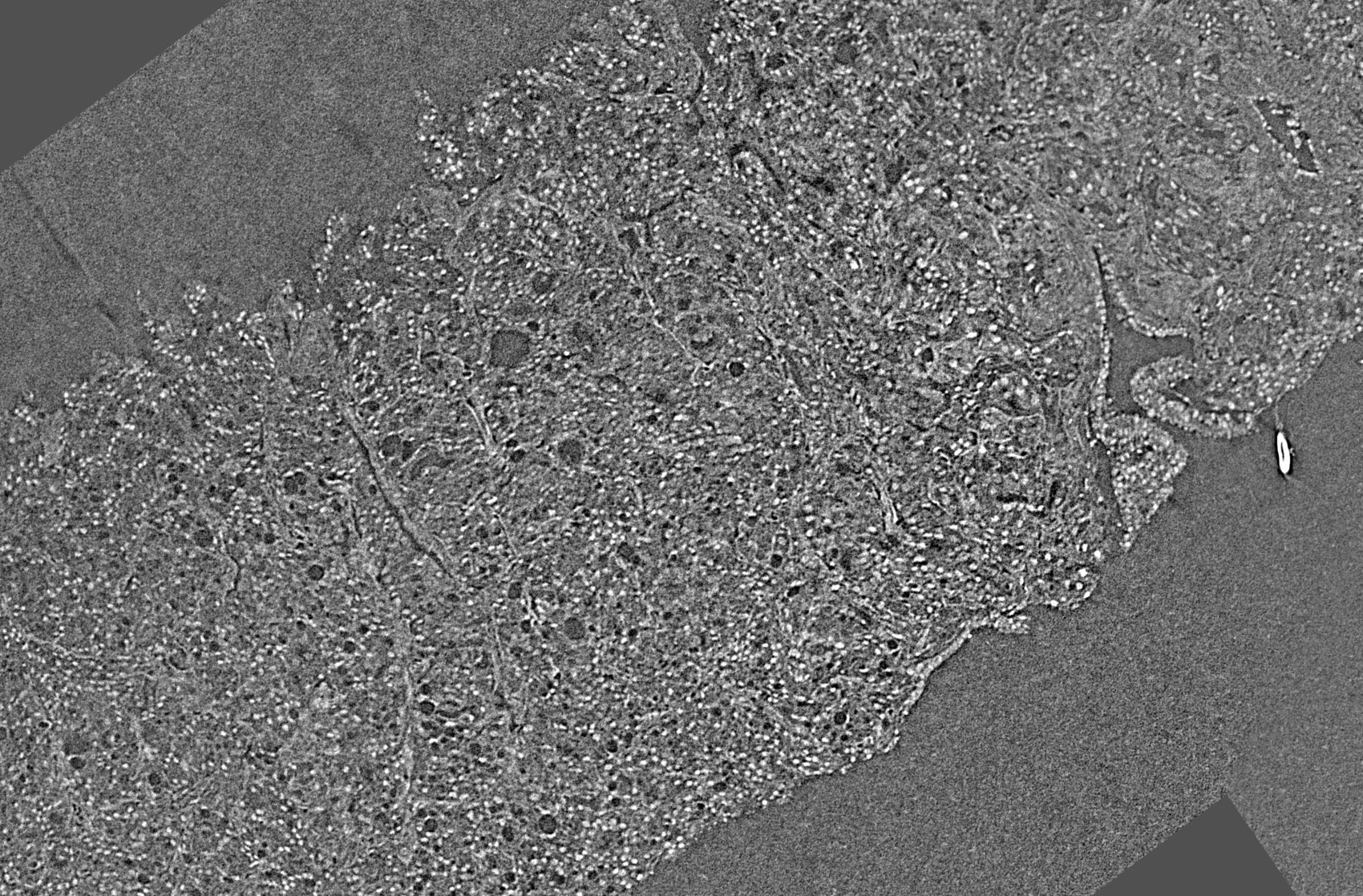 Phase-contrast microCT slice of an unstained human prostate biopsy.