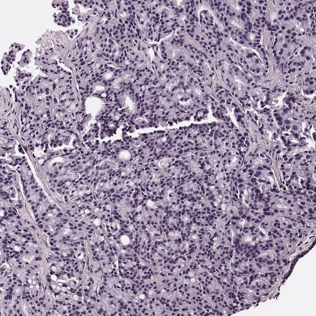Registered H and E histology section from the same tissue plane.