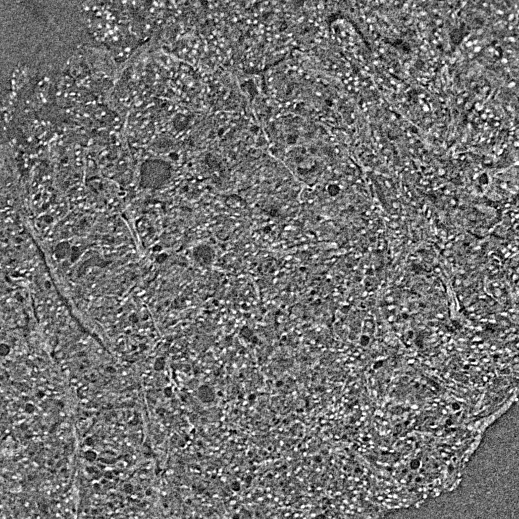 Registered PBCT micro-CT slice (placeholder)