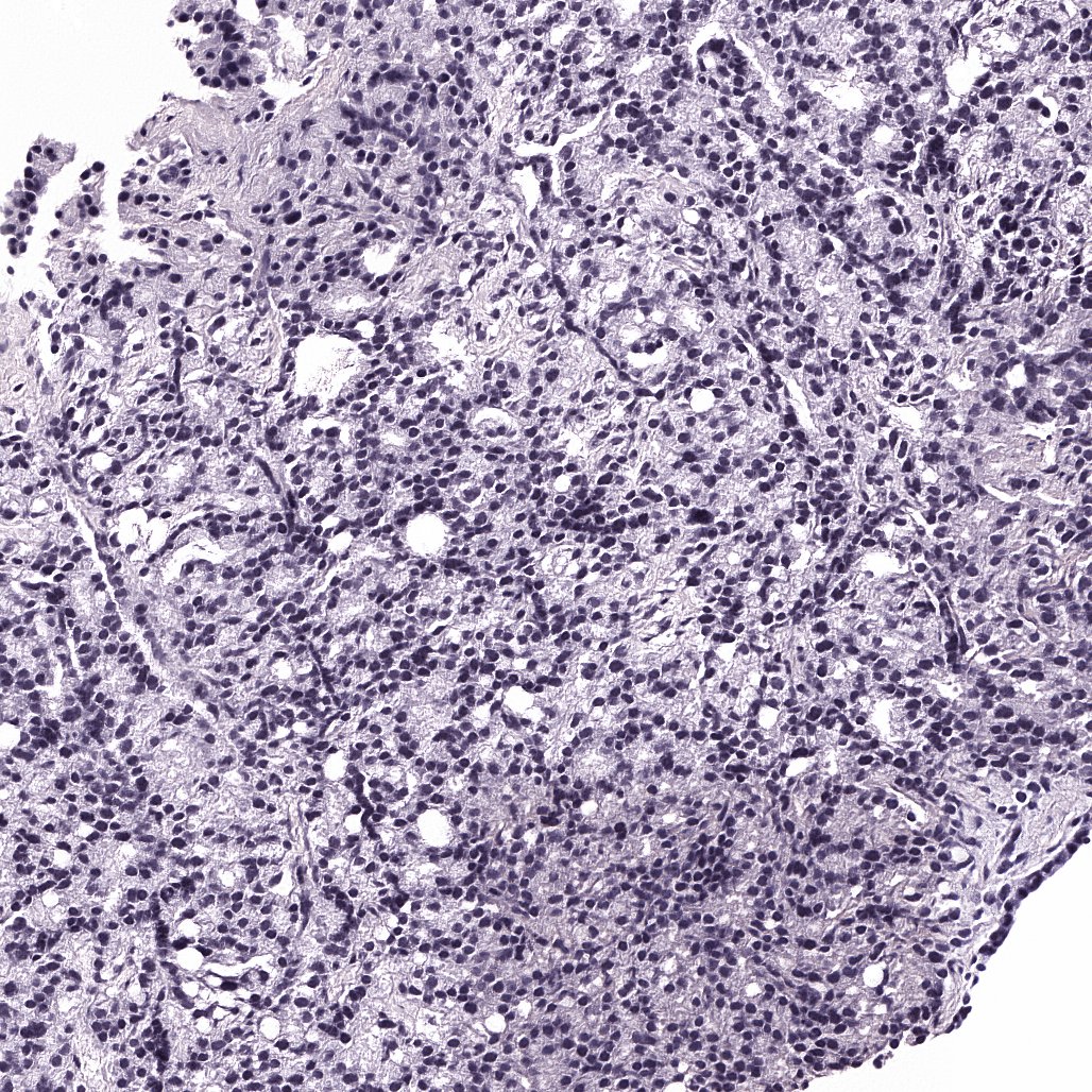 False-color view of a prostate biopsy micro-CT slice (placeholder)